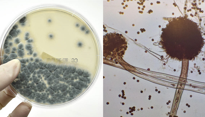 Hongo Aspergillus
