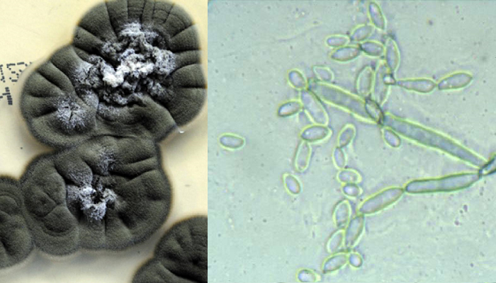 Hongo Cladosporum